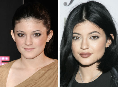 Kylie Jenner